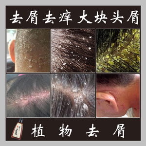 袋装健发元洗发水去屑止痒控油去大块头皮屑洗发水卡淇尔正品