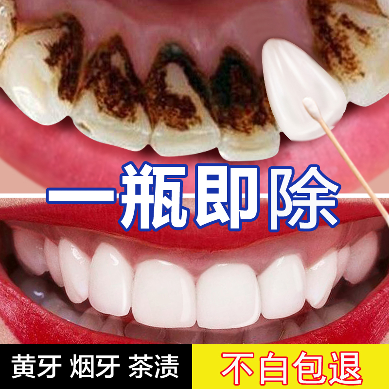 牙齿变美白速效神器溶解去黄牙牙结石烟渍牙渍去黄洗牙粉牙贴洁液