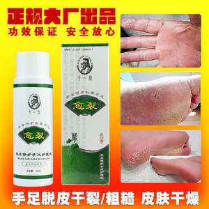 中一堂手足护理液愈裂手脚脱皮干裂脚垫皮肤干燥痒起皮屑皲裂老茧
