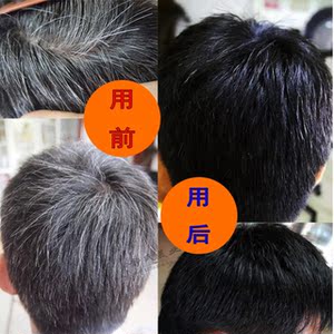 少年白发变黑发洗发水价格