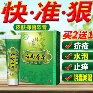 治疗慢性荨麻疹急裂痕过敏丘疹急风团型皮肤瘙痒止痒药膏中药正品 $28