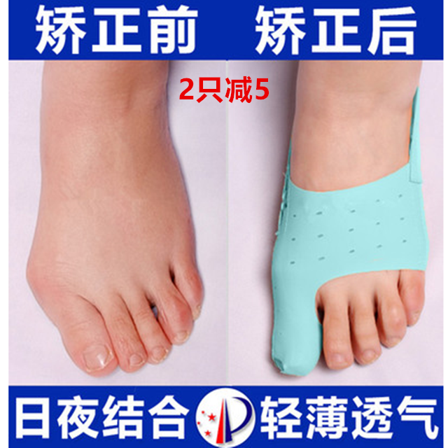 敏斯特日夜用大脚骨矫正器成人脚趾外翻矫正器儿童拇指外翻矫正器