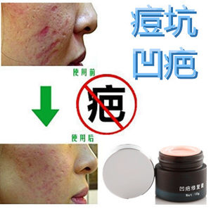 【去疤痕膏图片】去疤痕膏图片大全