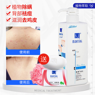 洗澡去鸡皮肤用什么药(洗澡去鸡皮肤用什么药膏好)