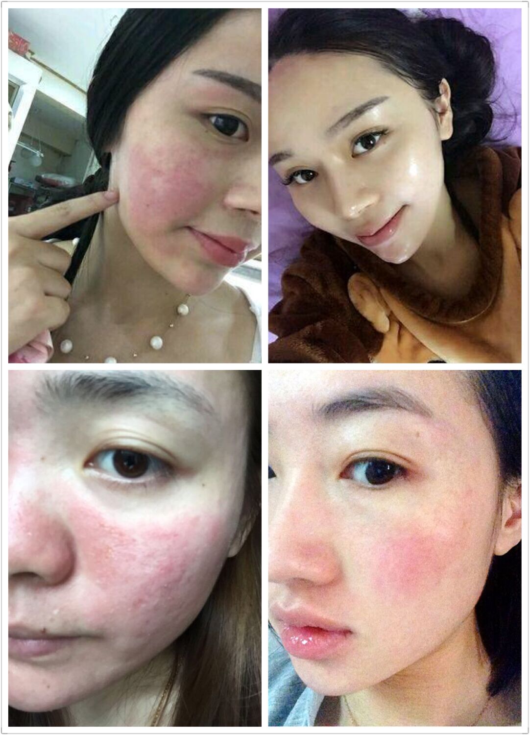 正品清丽阳薄荷清凉霜抗脸部膏抗过敏止痒霜祛红血丝15g护肤品 已售