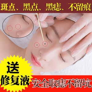 【祛痣膏点痣膏价格】最新祛痣膏点痣膏价格\/