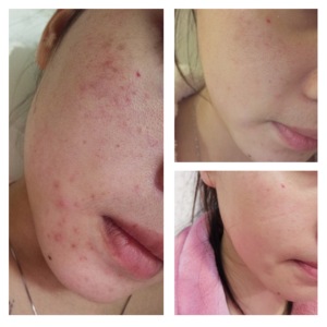 品牌名称: 康御肤精华液