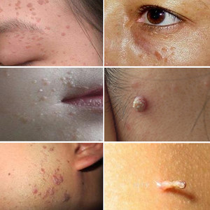 尿布疹软膏专场