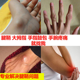 韩木缘腱鞘贴手腕贴大拇指疼痛舒筋贴腱鞘膏妈妈手腱鞘贴疼痛贴